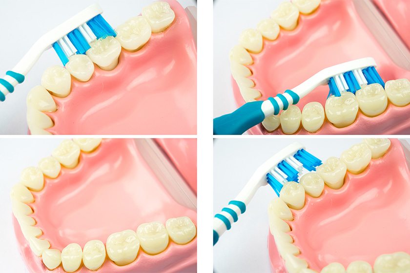 Diş Fırçalama Teknikleri
