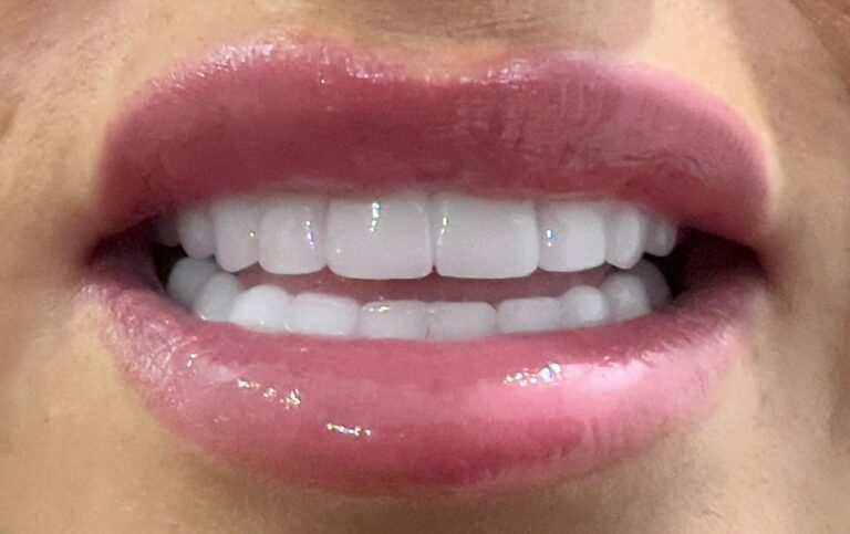 WhatsApp-Image-2022-06-15-at-14.05