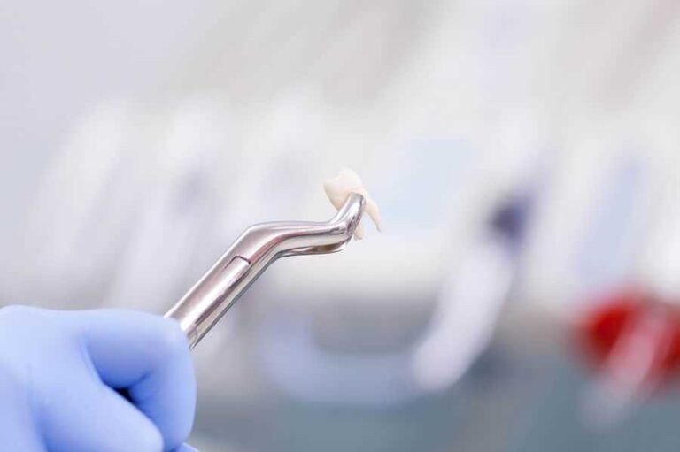 Diş Çürümesi Nedir?